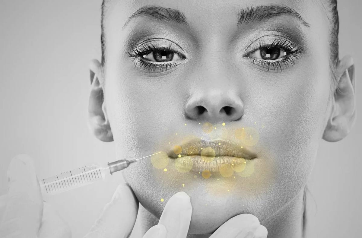 Valoración médica de labios con jeringa en medicina estética facial