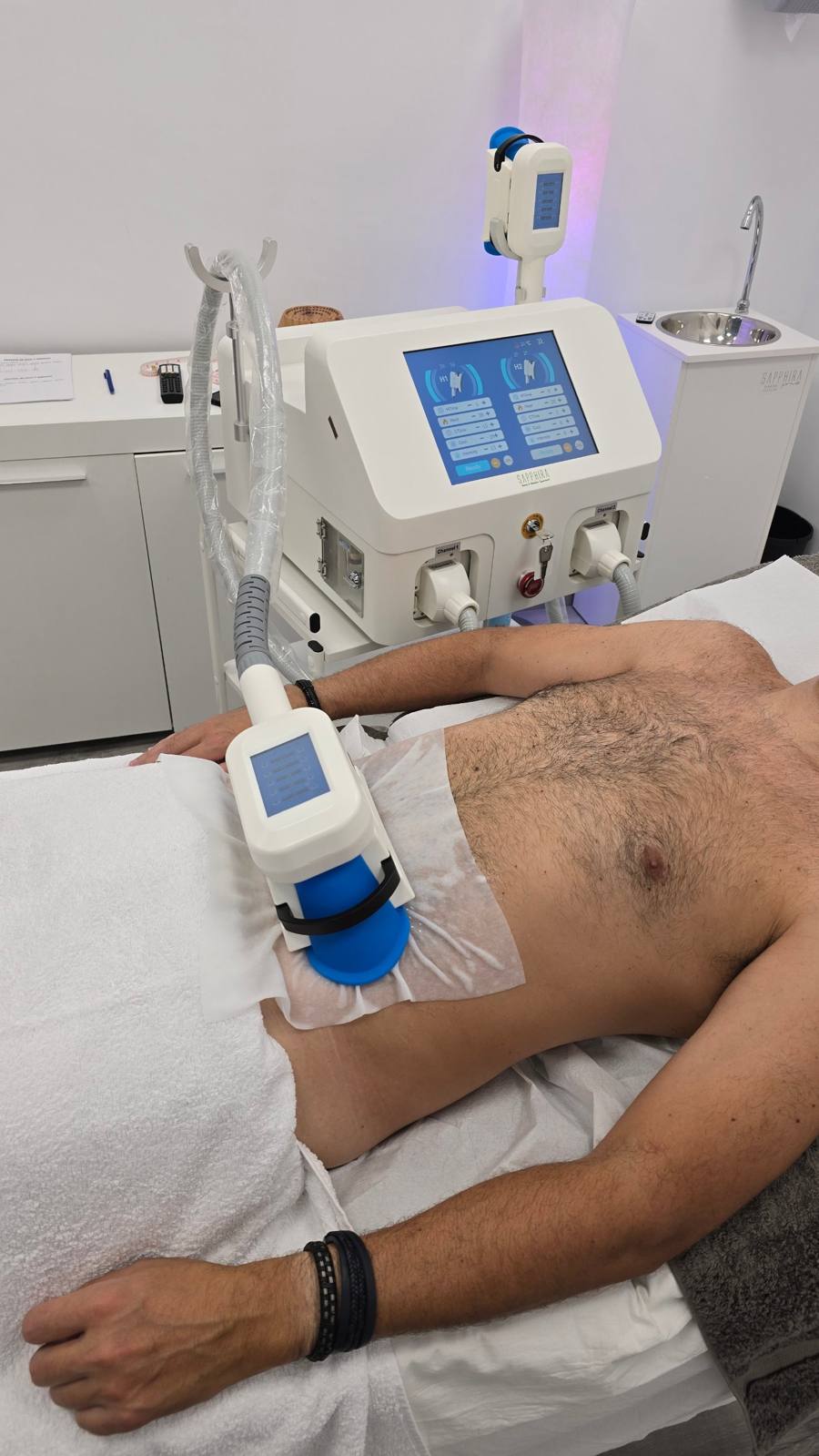 Sesión de criolipólisis con aplicador en el abdomen